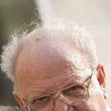ДПХ и androgenetic alopecia