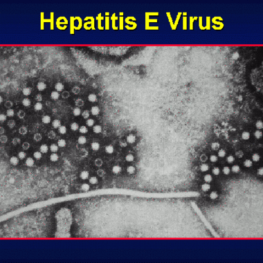 Current Knowledge on Hepatitis E Virus Infection
