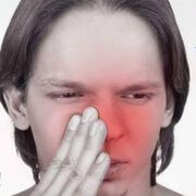 Хомеопатия – верният съюзник в борбата с хремата