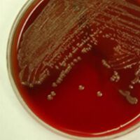 Optimization of Eva Green real-time PCR for differentiating
C. jejuni/coli directly from feces