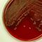 Optimization of Eva Green real-time PCR for differentiating
C. jejuni/coli directly from feces