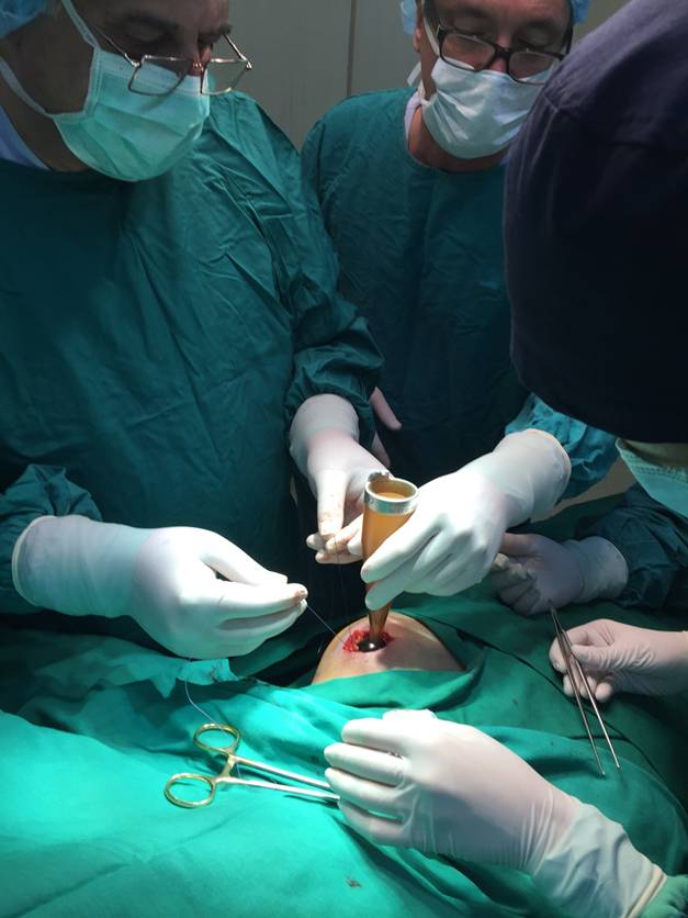 Иновативен метод за лечение на рак на гърдата щади здравето на пациентите