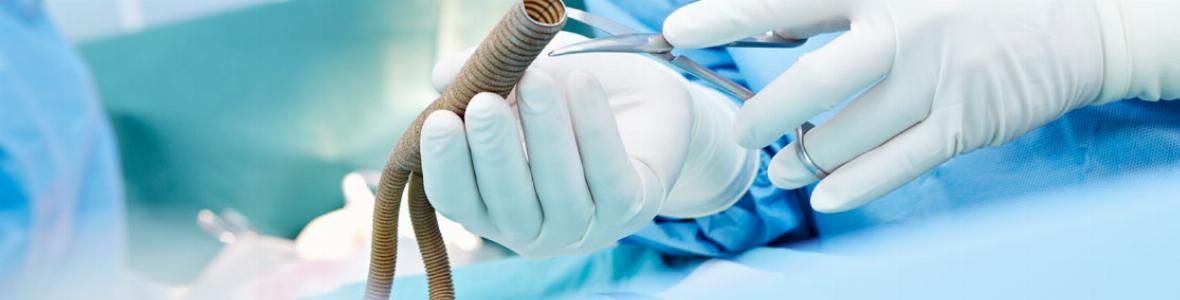 92-годишна пациентка с рядък тумор е оперирана успешно в УМБАЛ Бургас