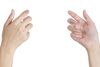 Синдром на извънземната ръка/Alien hand syndrome(AHS)