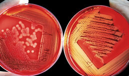 Връзката между Klebsiella и коликите