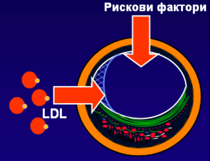 Какво препоръчват клиничните указания за лечение на LDL-C при пациенти с много висок риск от ASCVD