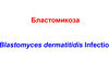 Бластомикоза / Blastomyces dermatitidis Infection