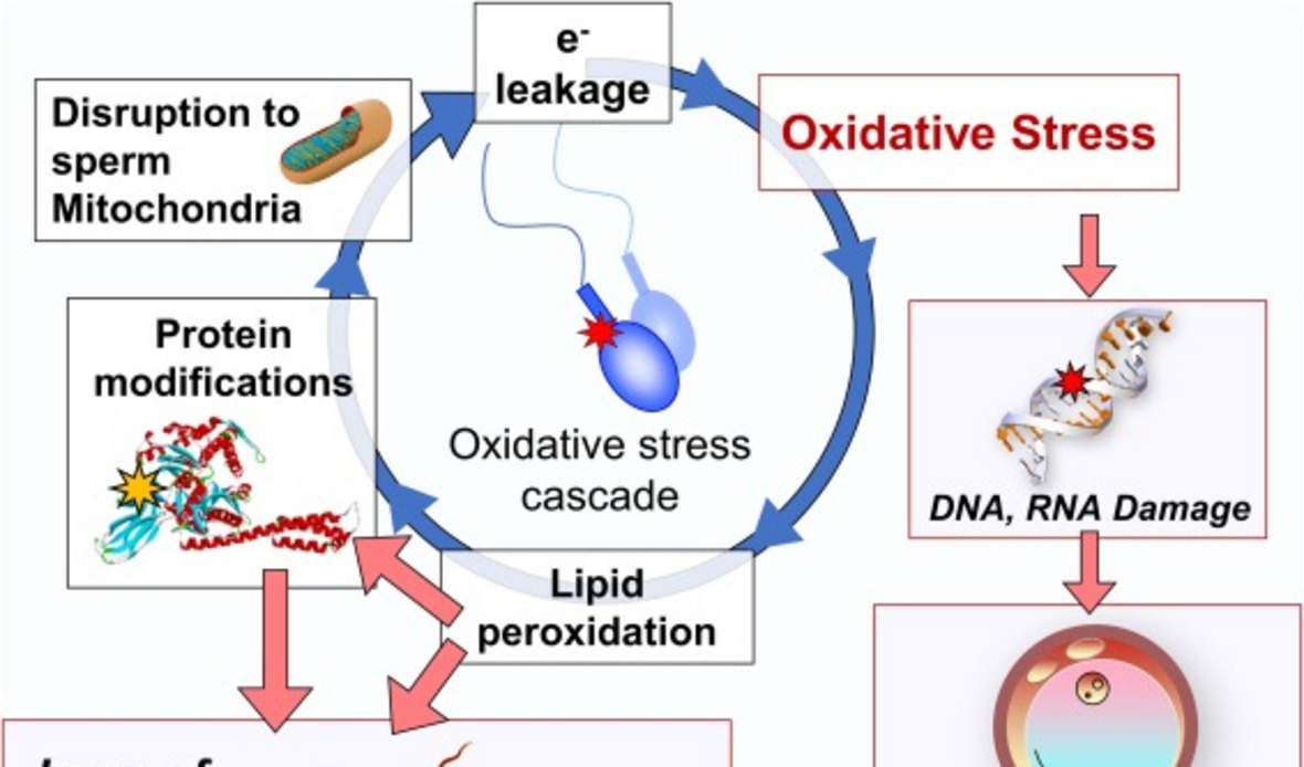 Glutathione content and glutathione peroxidase activity of sperm in males with unexplained infertility