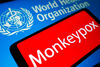 СЗО: Сериозна заплаха е наличието на огнища на маймунска шарка в над 50 страни