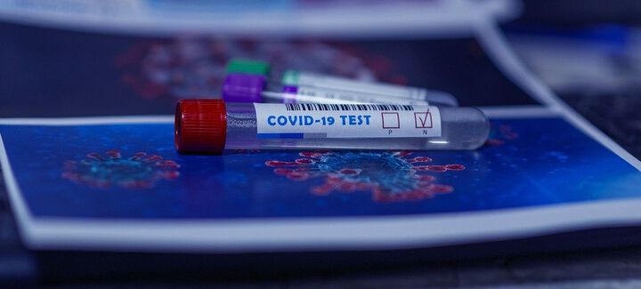 РЗИ са закупували антигенни тестове за ковид по цени в пъти по-високи от нормалните