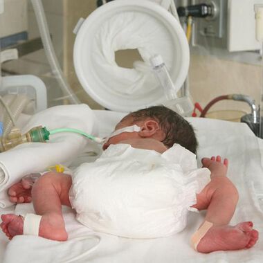 6124 бебета родени недоносени у нас за година