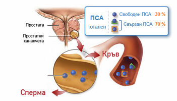 Повишен туморен маркер за простатата (ПСА) - какво да правя?