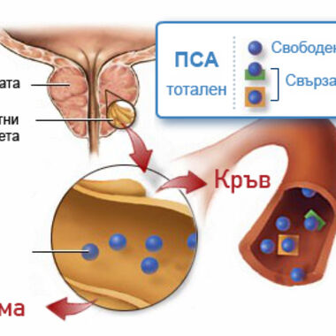 Повишен туморен маркер за простатата (ПСА) - какво да правя?