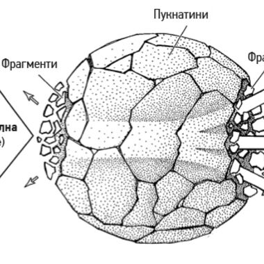 Как се разбиват камъни в бъбреците?
