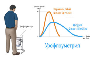 Проблемите с уринирането след 50?