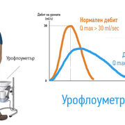 Проблемите с уринирането след 50?