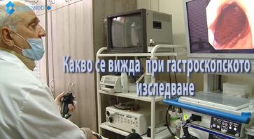 Как протича гастроскопията (ВИДЕО)