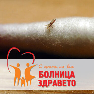 Как да се справим с въшките с естествени средства ?