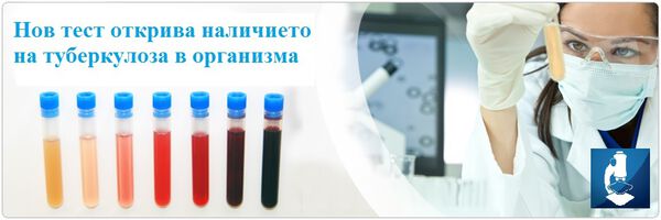Нов тест открива наличието на туберкулоза в организма