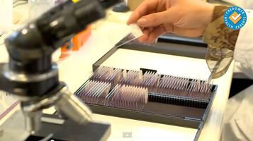 Генните мутации BRAC1 и BRAC2 са най-голям риск за рак на яйчниците