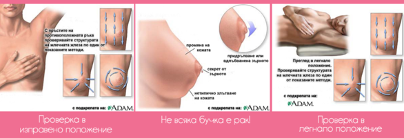 Мамологична профилактика