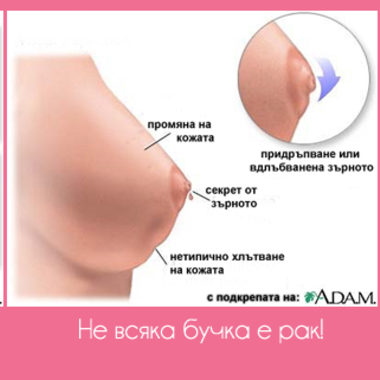 Мамологична профилактика