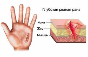 Кампания "ОГЛЕДАЙ СЕ ЗА СКРИТОТО"