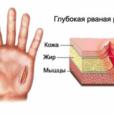 Кампания "ОГЛЕДАЙ СЕ ЗА СКРИТОТО"