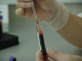 При по-тежките лимфоми шансът за постигане на продължителна ремисия е по-голям