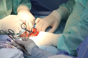 21-годишно момче от Варна стана донор на двама души