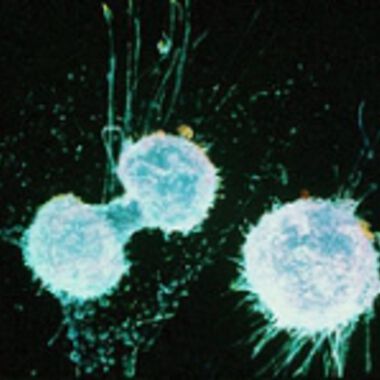 Изследване на циркулиращи туморни клетки при пациенти с рак на главата и шията