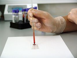 Диабетната полиневропатия - проследима на клетъчно ниво