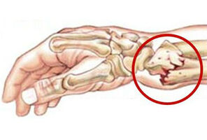 Изследване за Остеопороза и консултация със специалист ендокринолог за жени в менопауза