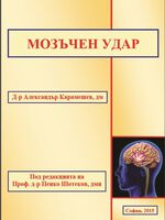 Мозъчен удар