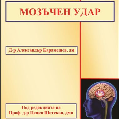 Мозъчен удар