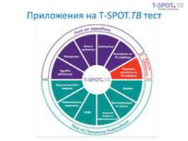 Три мита за туберкулозата