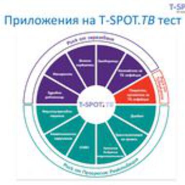 Три мита за туберкулозата