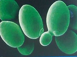Seroprevalence of EBV Infection in North-East Bulgaria