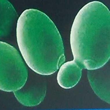 Seroprevalence of EBV Infection in North-East Bulgaria