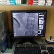 Медиците в УМБАЛ „Св. Анна“ спасиха живота на бременна жена и нейното бебе