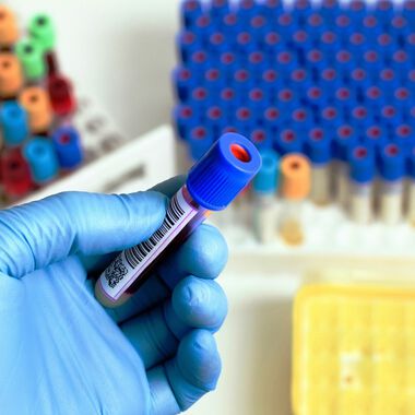 ОФЕРТА за отстъпки при платени изследвания