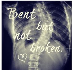 Идиопатична сколиоза (scoliosis idiopathica)