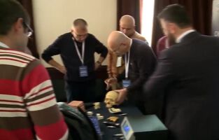 Отзвук от XXV Национална конференция по неврохирургия (ВИДЕО)