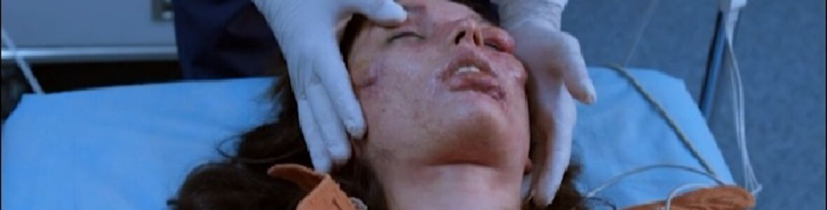 Когато каляската се превърне в тиква - наследствен ангиоедем
