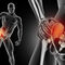 Osteoporosis, entrevista a Dr. Rubén Bucheli Terán