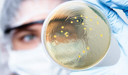 ASTRAZENECA FILES FOR US APPROVAL OF DRUG TO PREVENT COVID-19