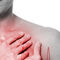 Enfermedades Cardiovasculares