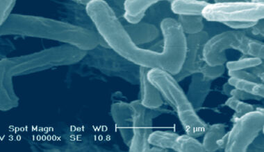 Nueva cepa de Bifidobacterium puede ayudar a mejorar la salud metabólica y mental