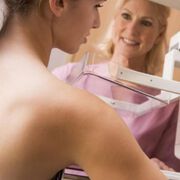 Association of schizophrenia with the risk of breast cancer Incidence