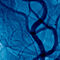Thermal Imaging for the Diagnosis of Early Vascular Dysfunctions: A Case Report